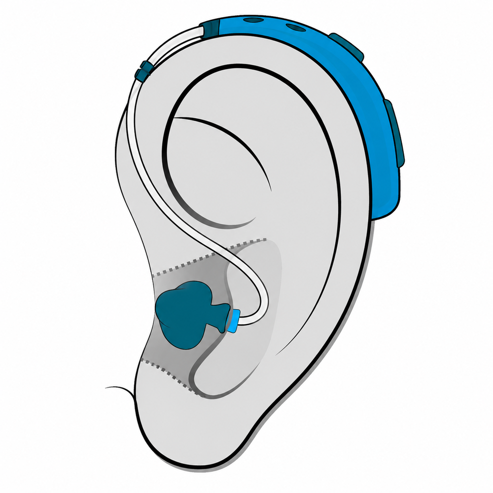 Behind-the-Ear (BTE) hearing aid style fitted at Brighter Hearing in Savannah, GA