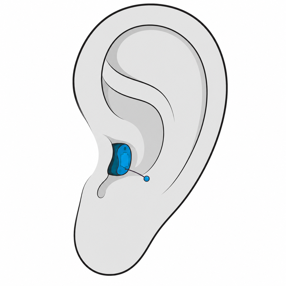 Completely-in-Canal (CIC) hearing aid style fitted at Brighter Hearing in Savannah, GA