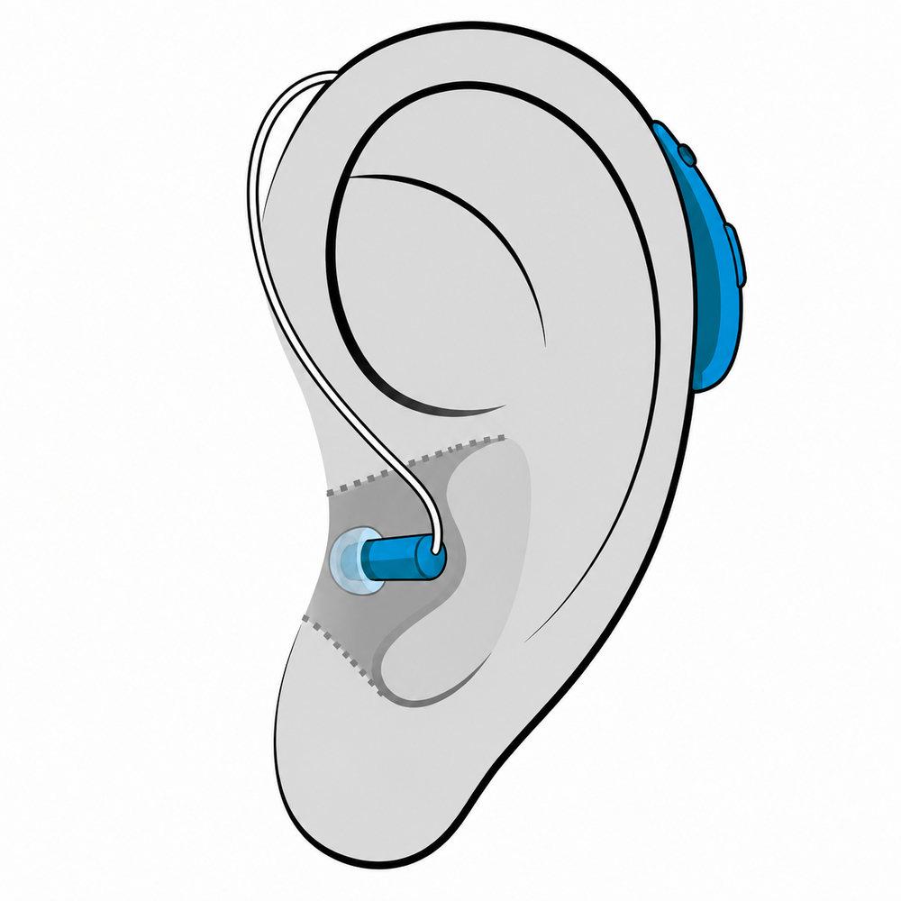 Receiver-in-Canal (RIC) hearing aid style fitted at Brighter Hearing in Savannah, GA